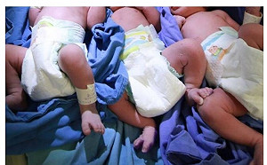 武漢肺炎夠毒！墨西哥3胞胎剖腹產 一出生就確診