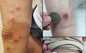 陳以信皮開肉綻？郭國文秀自己慘狀