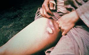 中國特殊人畜共通「鼠疫」擴大！  俄羅斯衛星通訊社:這是中國特有病菌