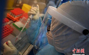 患者出現腦炎、中風、神經損傷 英國：冠狀病毒恐危害腦部！