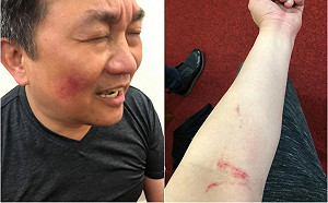 藍綠立委爆衝突 王定宇指控：國民黨團助理介入出手攻擊