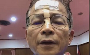 頭部見血仍直播 賴士葆：民進黨來20幾個 投出50幾票 作弊！