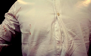 (影)白襯衫染血！領票遭藍委衝撞 林昶佐：選票得來不易