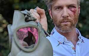 採訪波特蘭抗議眼睛遭射傷 攝影記者 : 被警方刻意當作目標