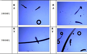 扯！女子眼睛癢 3根睫毛揪出17條活蟲 禍首竟是它....