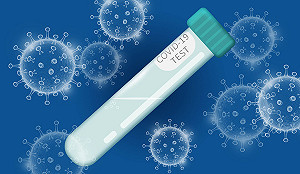 耶魯大學用唾液偵測武漢肺炎 獲美FDA批准