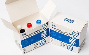 中國武肺試劑出包害3700瑞典人誤診 180國皮皮剉