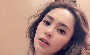 阿嬌頭破6公分大洞！經紀人曝驚悚傷照：從內層肌肉縫到表皮共數10針