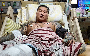 館長中槍17天曝復原狀況！狂操二頭肌 網笑：3公分回來了