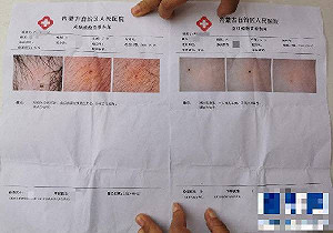 內蒙古幼兒園3老師涉針扎幼童遭帶走 股票上市母公司不認帳