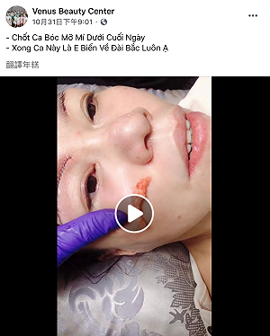 現場直擊》動刀當場被逮!越南25歲移工假冒醫美專家  專勤隊:最後客人是台灣人