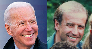 醫師懷疑拜登做整形手術！植髮、肉毒、拉皮樣樣來