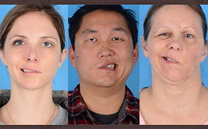 輝瑞疫苗沒問題？美4人爆不良反應