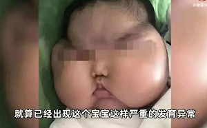 中國黑心「嬰兒霜」惹禍  5個月大女嬰飆重11Kg成「米其林寶寶」