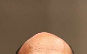 印度女子結婚5年才發現丈夫是禿頭 憤而報警逮夫