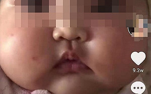 中國恐怖黑心嬰兒霜連環爆 家長痛心檢舉小孩使用後變「大臉娃娃」