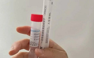 武漢肺炎「肛拭子檢測」不只中國有!西媒驚爆:西班牙也開始肛篩