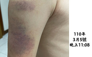 中市10歲童遭補教師毒打  綠營:媽媽市長要有對策