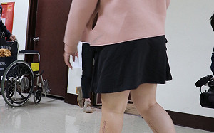 恐因心臟黏液瘤多處栓塞需截肢！北榮醫療團隊24小時接力 救回22歲女子雙腳