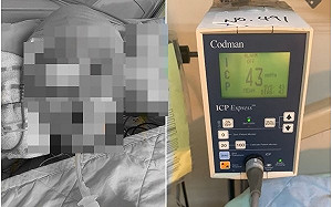 集氣！台中童學柔道腦死 腦壓｢120降到43｣父約定康復後一起去滑草