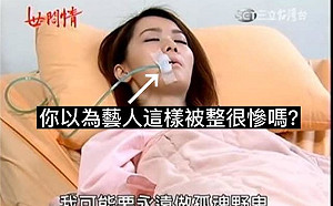 八點檔昏迷戲亂插管 ICU醫生陳志金:藝人很可憐