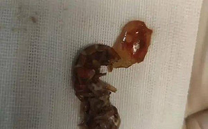 虐待動物!中國少年用肛門「榨蝦乾」小龍蝦反鑽腸道求生 7hr取出慘死