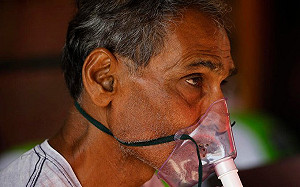 捨眼救命!印度武肺患者陷毛黴菌危機 死亡率過半