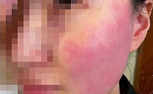 惡劣!比利時駐韓大使中國籍夫人賞店員巴掌 竟還用外交豁免權脫罪