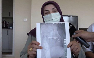 拍謝 我有東西在你肚子裏忘了拿出來! 婦人手術後常劇痛 照X光赫然發現一把剪刀