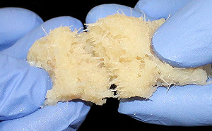 美多州暴發罕見結核病 CDC著手調查