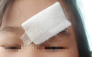 浪犬咬傷女童顏面 嘉縣動保員埋伏4天捕獲