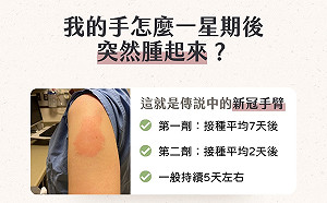 日調查莫德納手臂 施打後第9天3.5%民眾呈紅腫