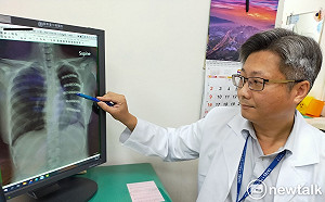 3D列印助攻見成效  掌握肋骨骨折手術黃金時間 不再擔心後遺症