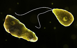 死亡率高達97% 湖中游泳感染「食腦變形蟲」 加州7歲男童身亡