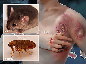 內蒙發現鼠疫患者 官方拖了一個星期才公布 啟動四級響應