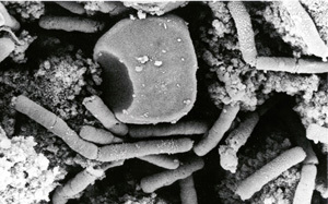 禍不單行！不僅新冠 中國3地爆「炭疽」病例 1死.投藥4700接觸者