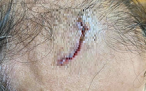 「傷疤照」寓意！ 張景森：永遠不要再讓黑暗力量統治台灣土地