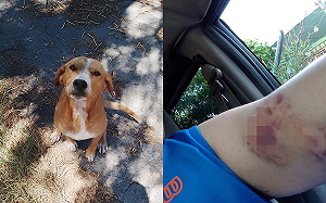 男遭浪犬狠咬仍照顧　見面大反轉！