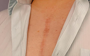 何博文曝沒當兵真相 胸前20公分傷疤是母親「最不願面對的痛」