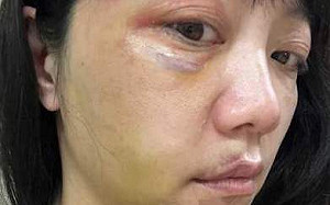 竟為此被林秉樞暴怒毒打!高嘉瑜:幫他買藥 藥袋沒寫一天服用幾次