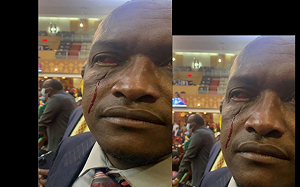 世界跟上台灣了？肯亞議會意見不合大打出手 議員被打到臉見血