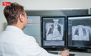 「120元心電圖就可抓出未來1~3年死亡機率！」 醫院擁抱AI 找出心臟危機