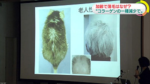 日研究：越老頭髮越稀疏是膠原蛋白變少
