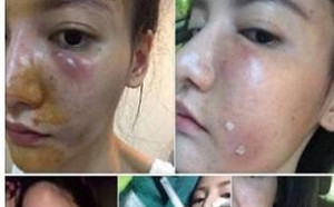 CNN專欄剖析「美白謊言」 數百萬美元市場背後的真相