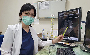 台中榮總嘉義分院：外食、作息不正常導致中風年輕化