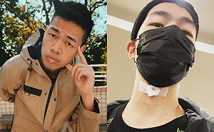 陳大天深夜曝多年隱疾！認「聲帶動手術」：2天不能說話