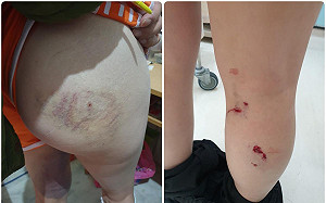 女送貨員遭3犬狂咬全身傷　怒提告