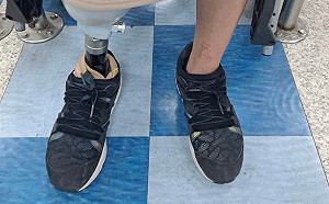 10萬元打發工傷截肢女員工 苗縣議員曝：是頭份知名公司