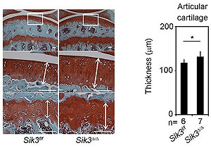 日研究確認：蕨類成分有效抑制關節炎