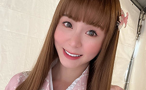 從小被嘲笑「禿頭」！短今自曝「植髮3299根」：告別高額頭